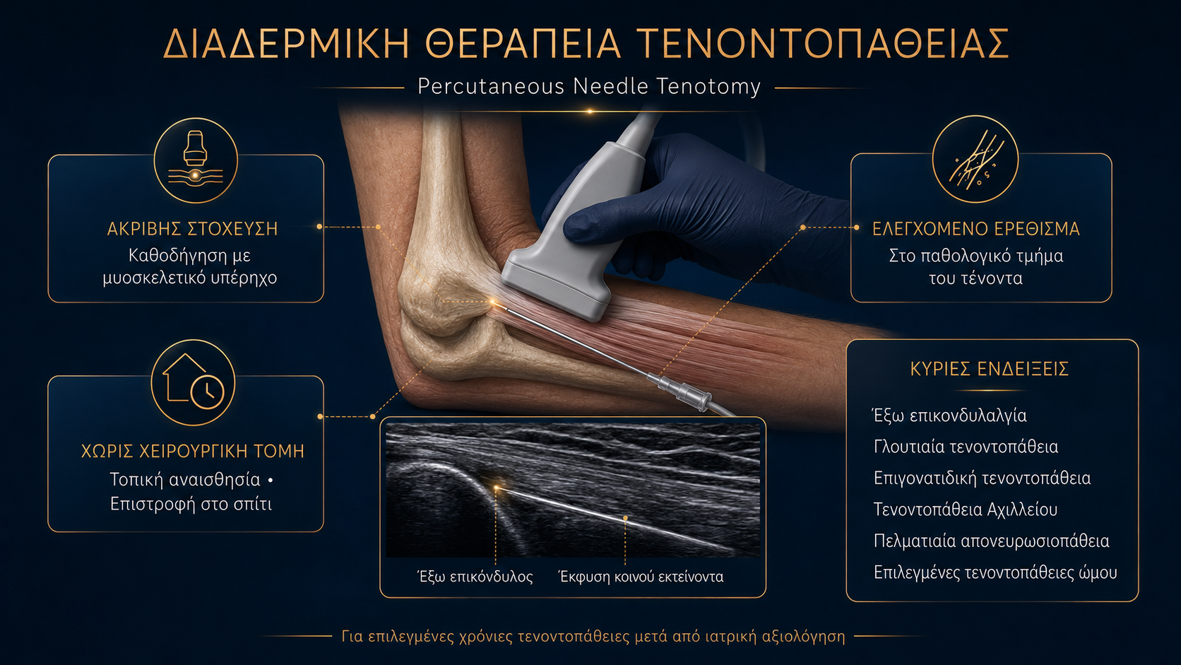 Υπερηχογραφικά Καθοδηγούμενη Διαδερμική Θεραπεία Τενοντοπάθειας